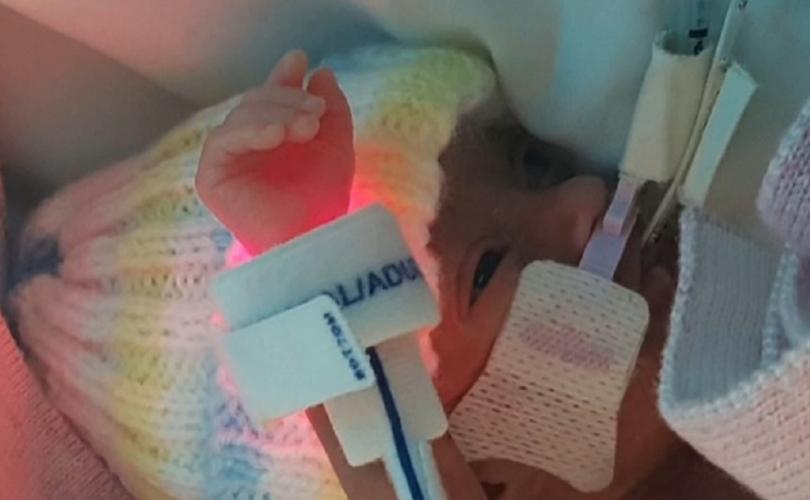 Un Beau Bebe Ne Prematurement Plus Petit Qu Un Paquet De Lingettes A 24 Semaines Campagne Quebec Vie