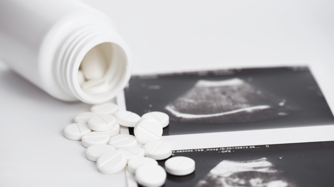 How to respond to Government consultation on DIY abortions