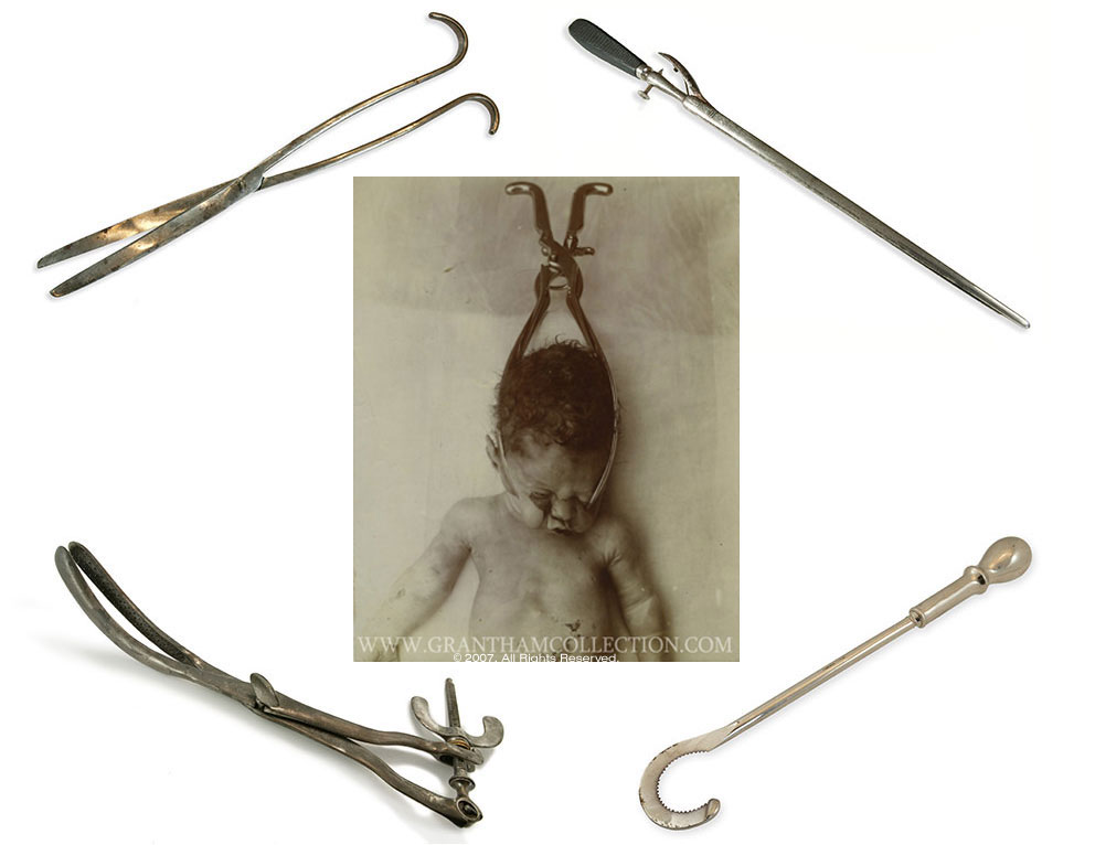 Abortion Instruments - Centre for Bio-Ethical Reform UK
