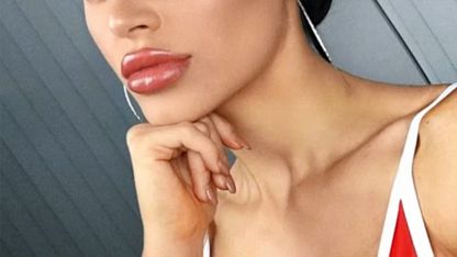 Predatory cosmetic surgery barbarians must be made accountable for the harm they cause