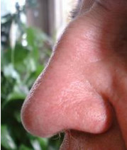photo of human nose