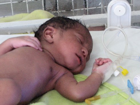 infant patient