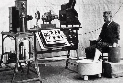 photo of patient with hands and a foot in vats, with large apparatus