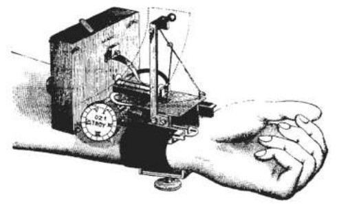 drawing of device strapped to wrist of a patient
