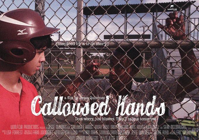 callousedhands.jpg
