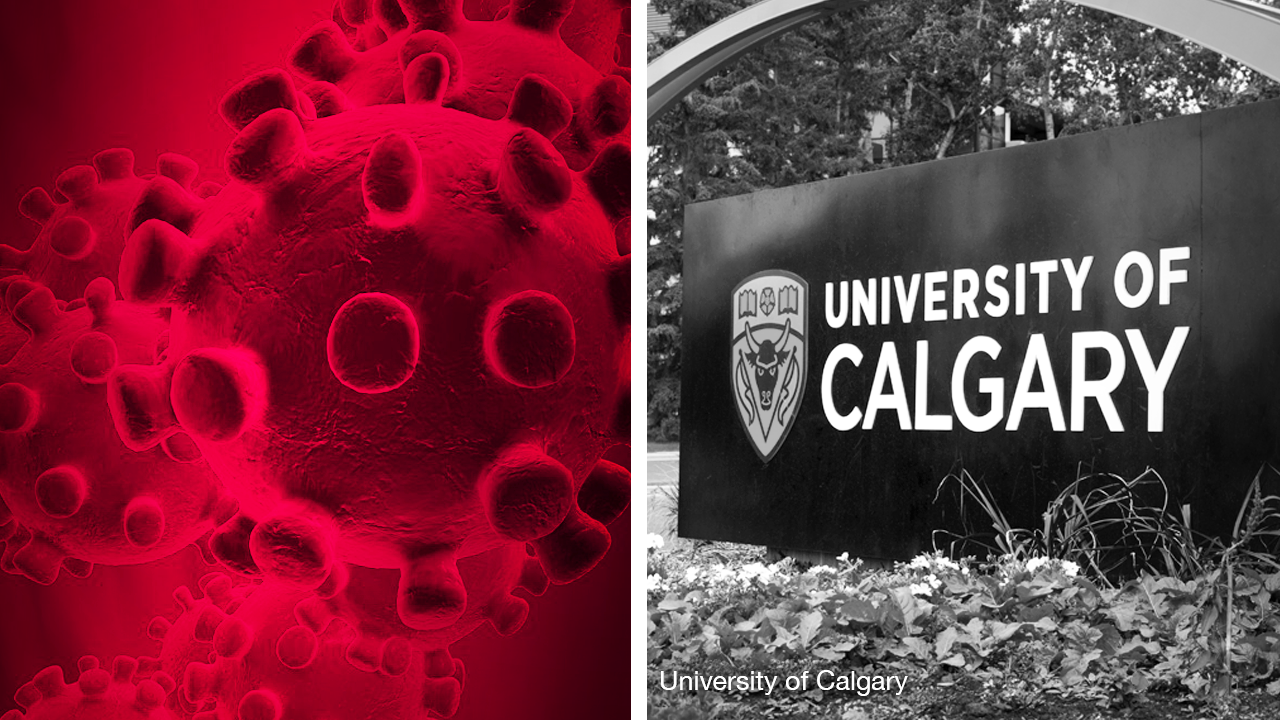 uCalgary asks professors to prepare for campus closure amid coronavirus outbreak